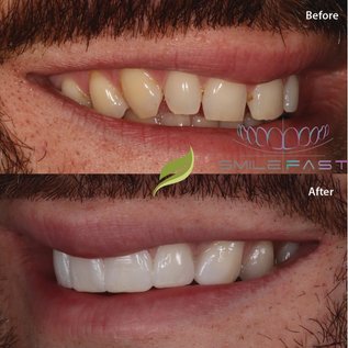 Before and after dental treatment 3